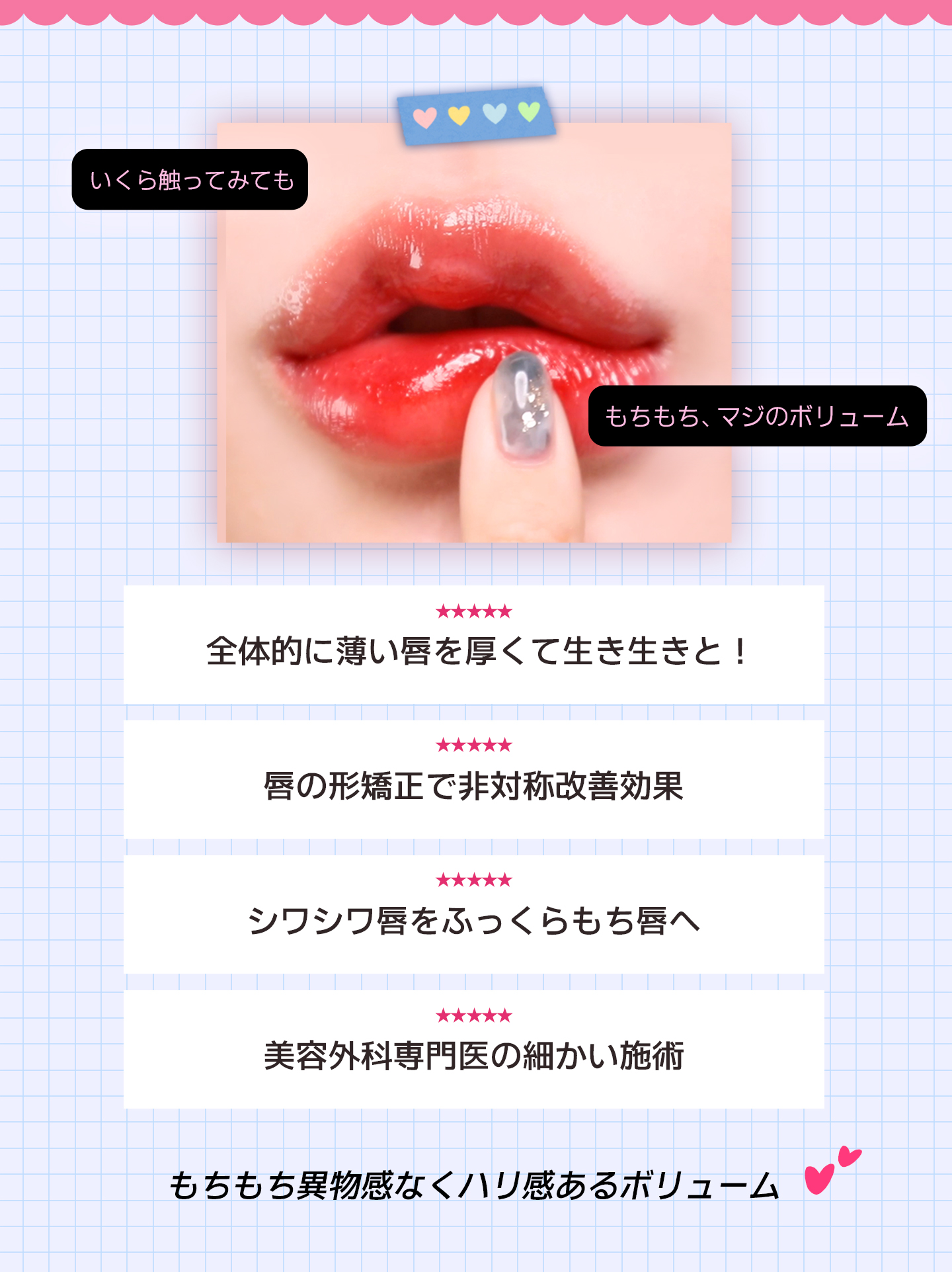 唇フィラー